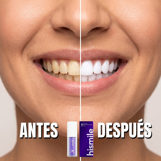 HiSmile V34 Colour Corrector — Sérum Morado Corrector de Color Dental (30 ml · Original)