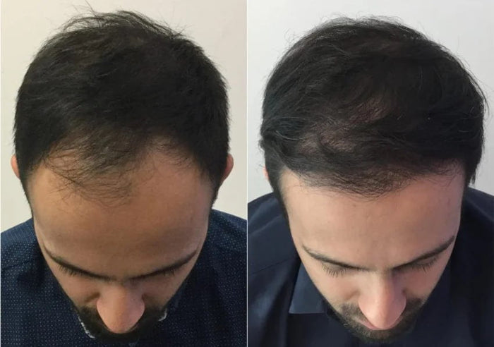 Antes y después Raizal