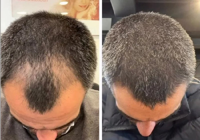 Antes y después Raizal