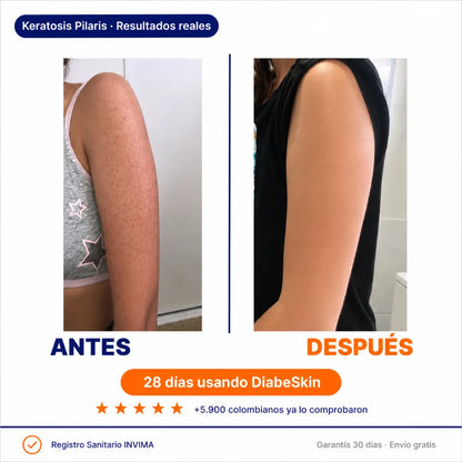 DiabeSkin | Ultrahumectante
