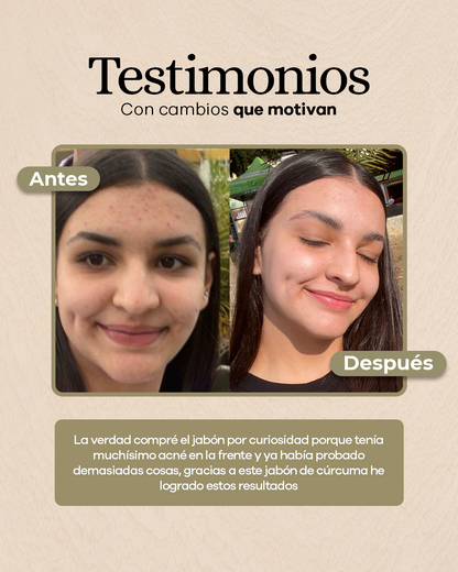 Jabón Aclarante con Cúrcuma y Ácido Kójico