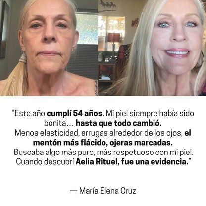 ProLift 2.0 Micro-Conos para Ojos Maduros