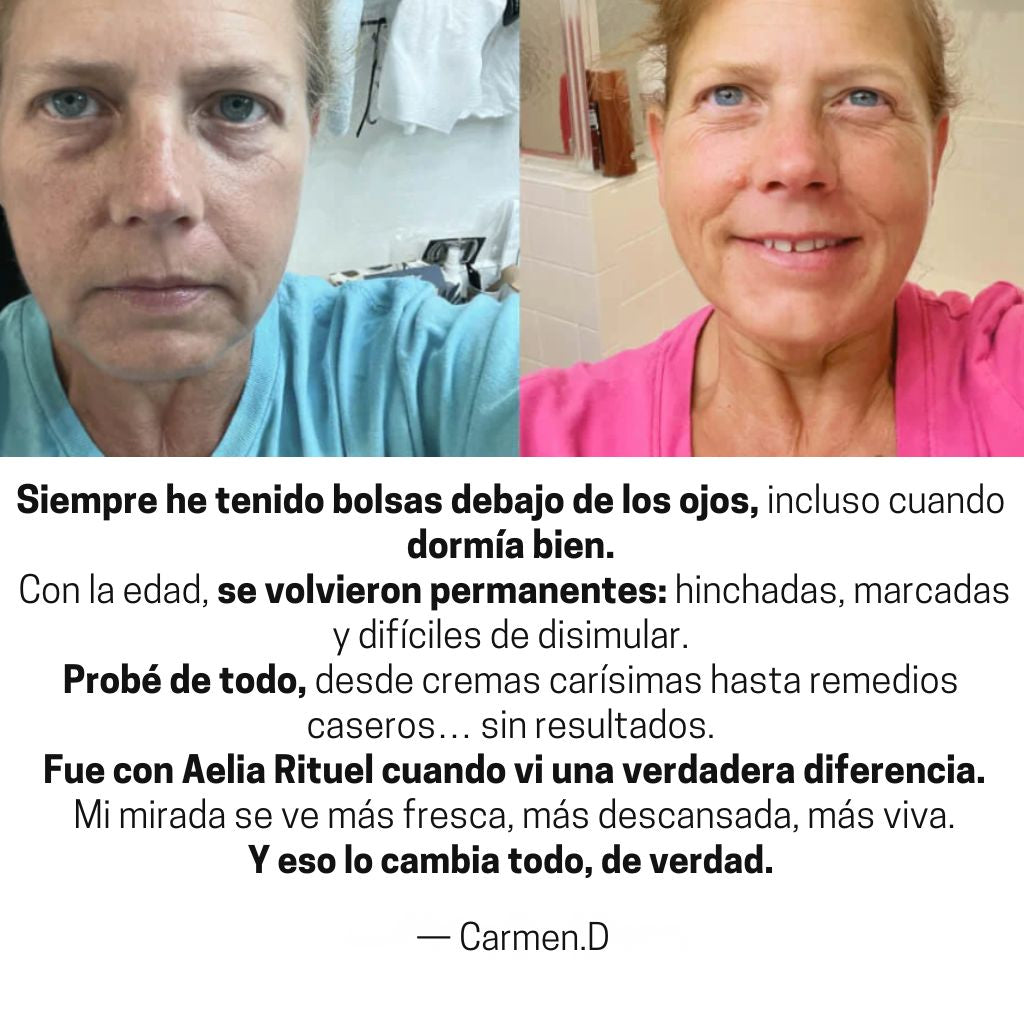 ProLift 2.0 Micro-Conos para Ojos Maduros