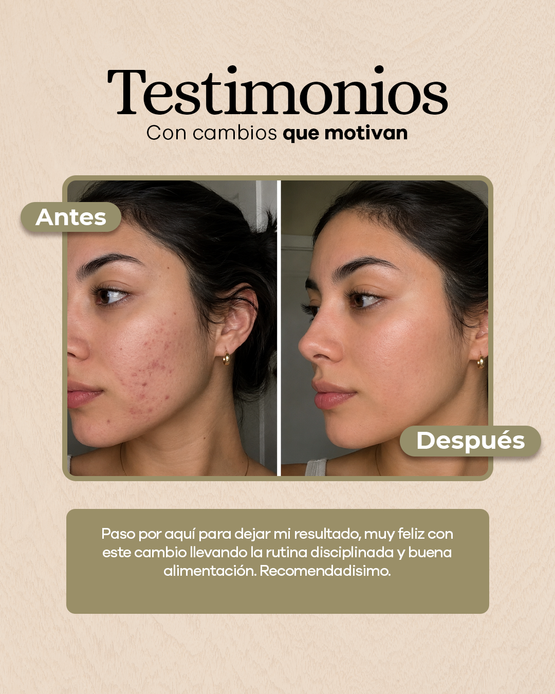 Jabón Aclarante con Cúrcuma y Ácido Kójico