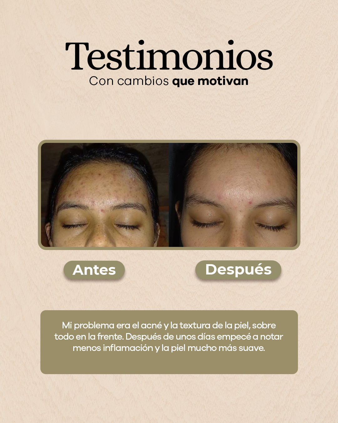 Jabón Aclarante con Cúrcuma y Ácido Kójico
