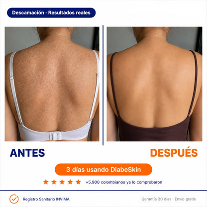 DiabeSkin | Ultrahumectante