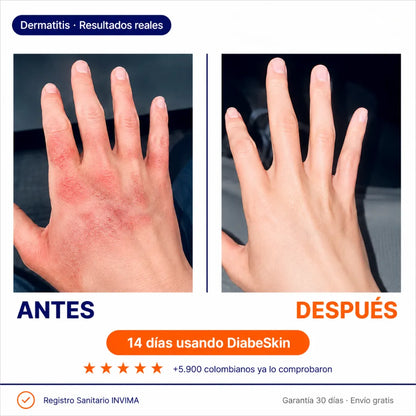 DiabeSkin | Ultrahumectante