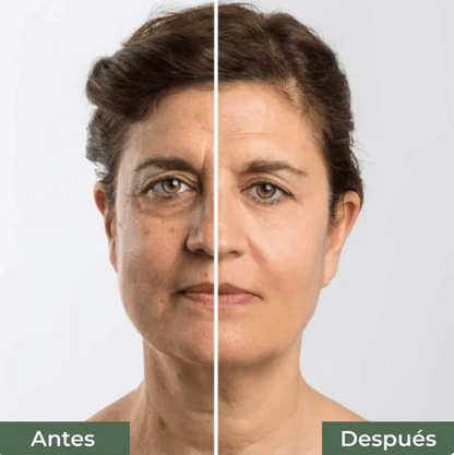 SERUM NZ ANTIARRUGAS