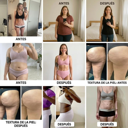 Lipo Lift –  Crema Reafirmante Intensiva