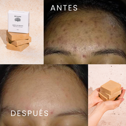 Jabón Aclarante con Cúrcuma y Ácido Kójico
