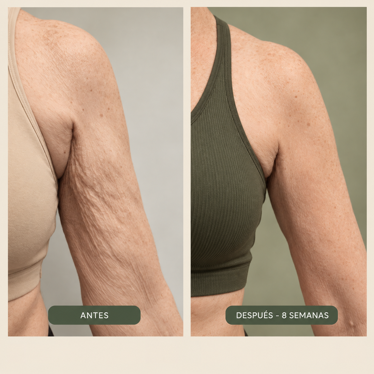 Dermavè™ | Aceite Corporal Reafirmante - Anticelulitis , flacidez y arrugas