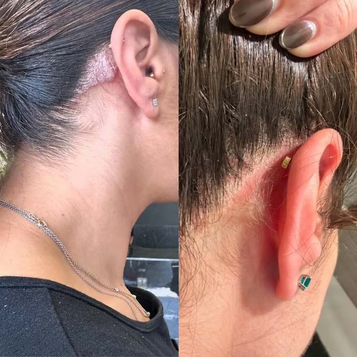 Antes y después Herbora