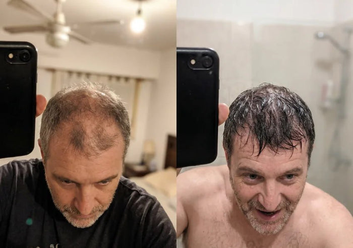 Antes y después Raizal