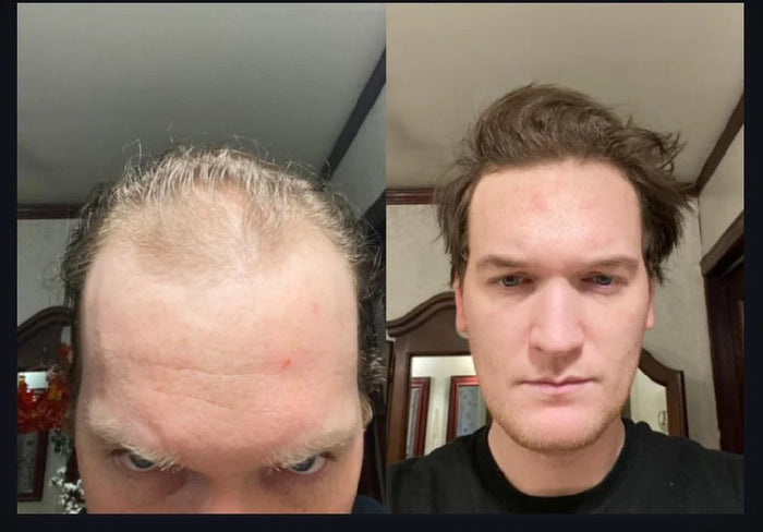 Antes y después Raizal