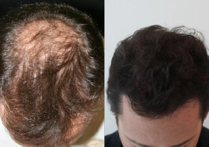 Antes y después Raizal
