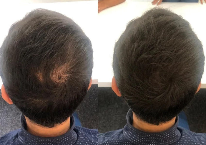 Antes y después Raizal