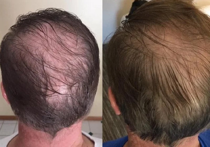 Antes y después Raizal