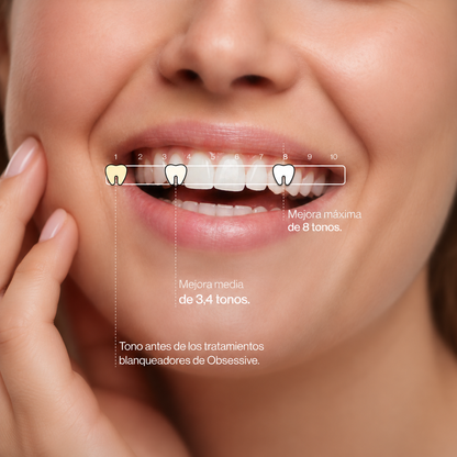 PURPLE V34 - Blanqueador Dental