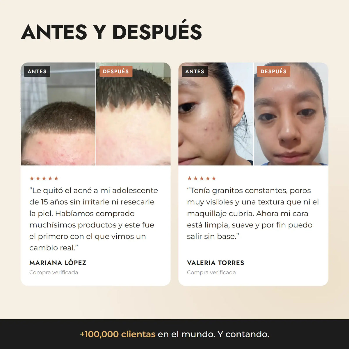Secret Teint Précieux — Tratamiento Jabón Mascarilla para el Acné