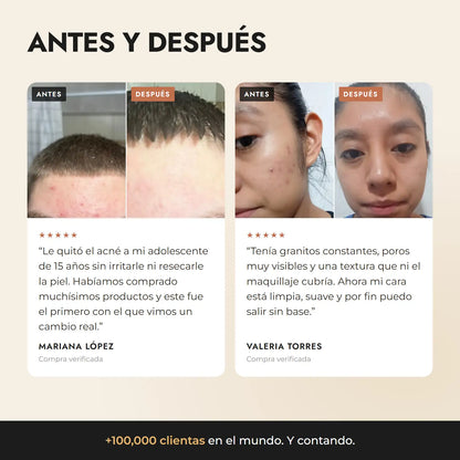 Secret Teint Précieux — Tratamiento Jabón Mascarilla para el Acné